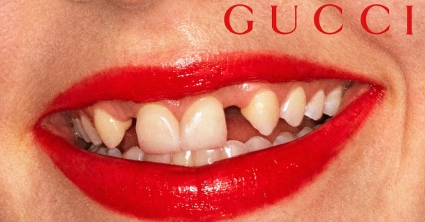 This is the perfect smile, according to Gucci